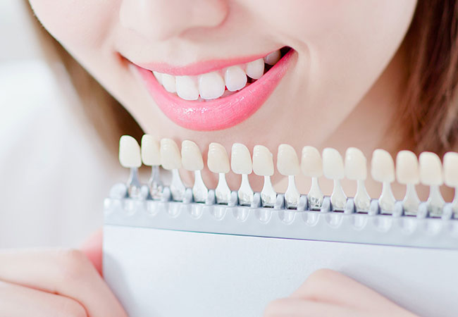 ホワイトニングとは