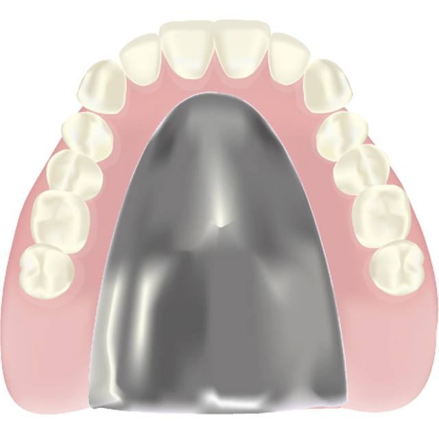 チタン床義歯