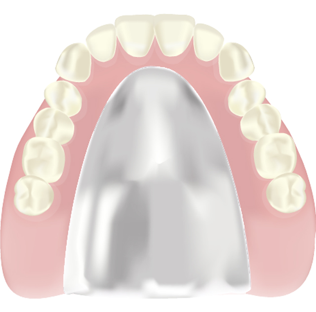 コバルトクロム床義歯