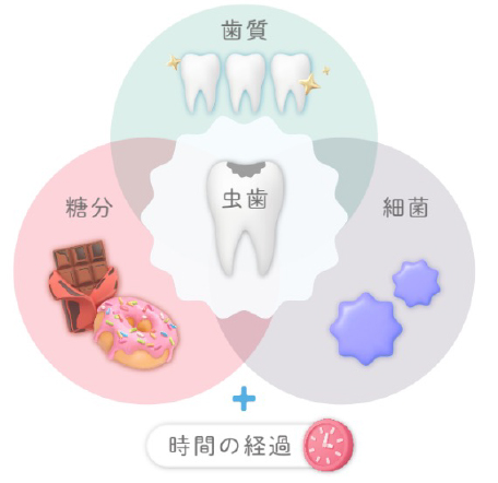 むし歯が起こりやすくなる原因