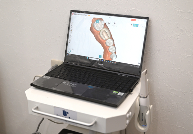 デジタル印象システム